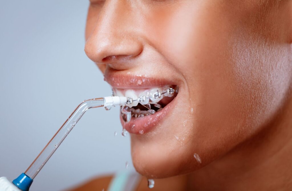 A person with braces opens their mouth to use the water flosser to floss and clean their teeth.