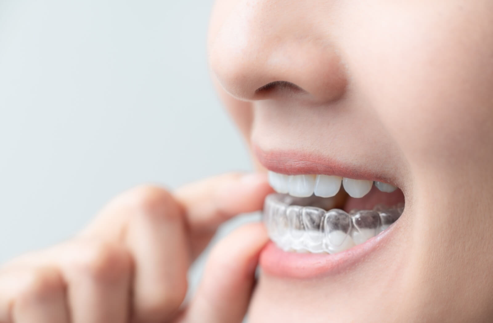 A close-up of a person using their finger to adjust a clear Invisalign aligner over their bottom teeth.